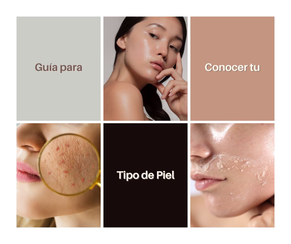 Cómo saber mi tipo de piel: guía visual con ejemplos de piel grasa, piel seca y piel con acné.